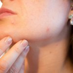 food sensitivities can cause skin irritation